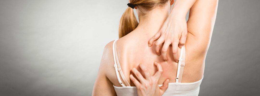 Jeuk over hele lichaam zonder uitslag Perfect Age