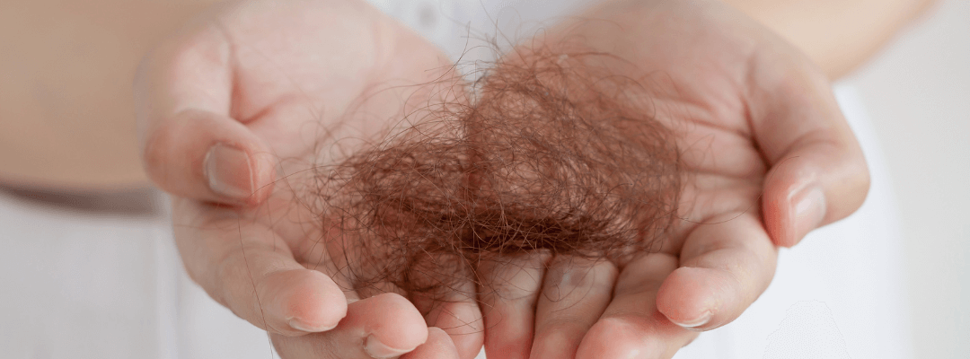 haaruitval vrouwen oorzaak perfect age oplossing (1)