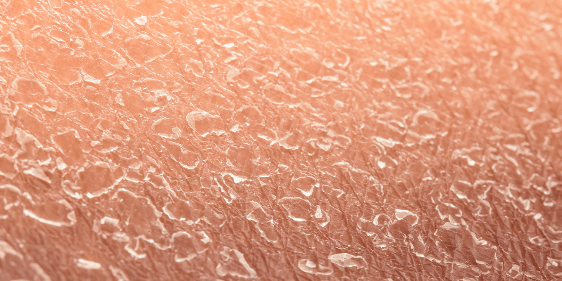 Hoe hydrateer je je huid Perfect Age (1)